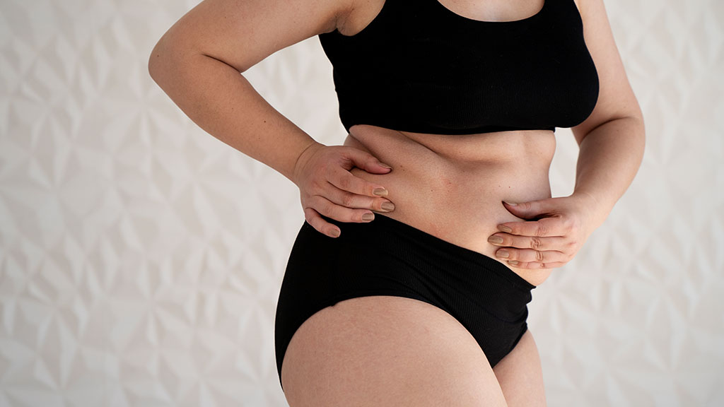 Sculpt Your Flanks with Liposuction Targeting Love Handles Effectively cincinnati