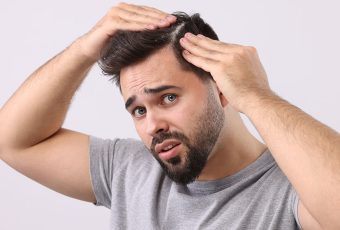 Should You Choose SmartGraft or Stick with Topical Hair Loss Treatments?