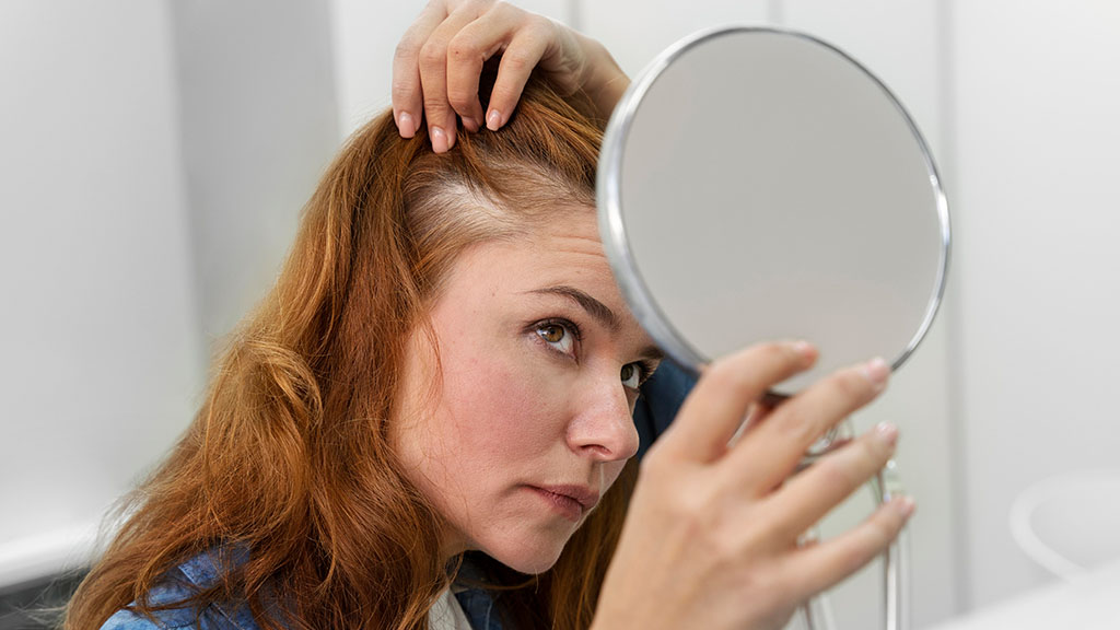 SmartGraft for Female Hair Loss Safe Effective and Scar-Free cincinnati