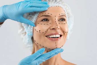 What Type of Facelift Lasts the Longest?
