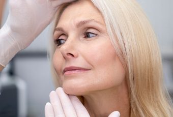 Complete Guide to PDO Threads and PDO Thread Lift: Benefits, Types, Procedure, and Costs