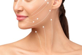 Thread Lift for Jowls: The Secret to a Sharper Jawline
