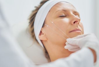 Why an Instant Thread Facelift Might Be the Best Non-Surgical Lift for You