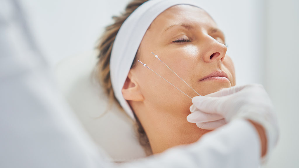 threadlift cincinnati face lift instant