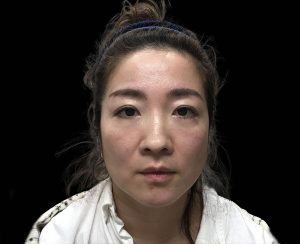 emface results