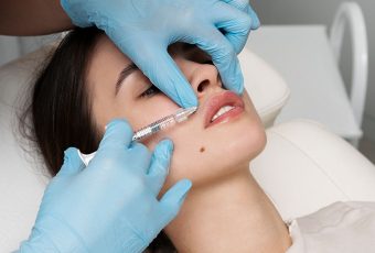 Lip Filler Touch-Ups: How Often Should You Get Them?