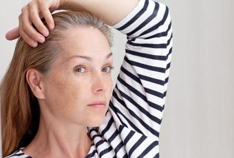 PRP for Postpartum Hair Shedding: A Safe Solution for New Moms