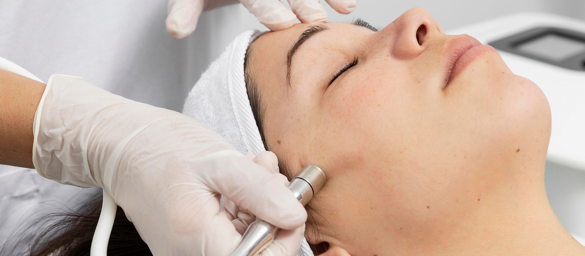 microdermabrasion cincinnati the dermatology laser and vein center