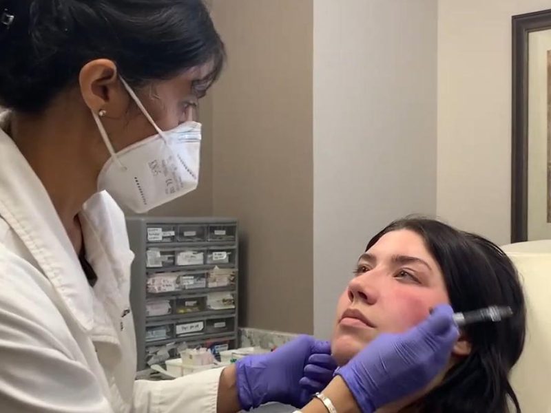 laser & vein center cincinnati